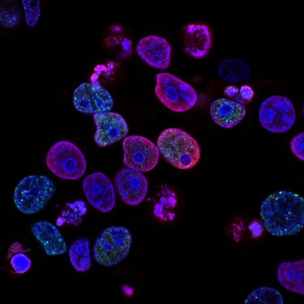 Workshop: Sample Vitrification Best Practices — Registration Now Open
